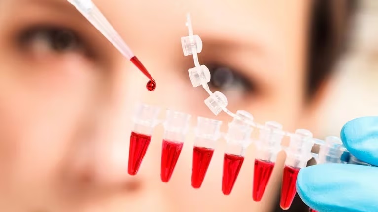 Investigadores desarrollaron un nuevo tipo de análisis de sangre que detecta 18 tipos de cáncer en etapas tempranas test - 10