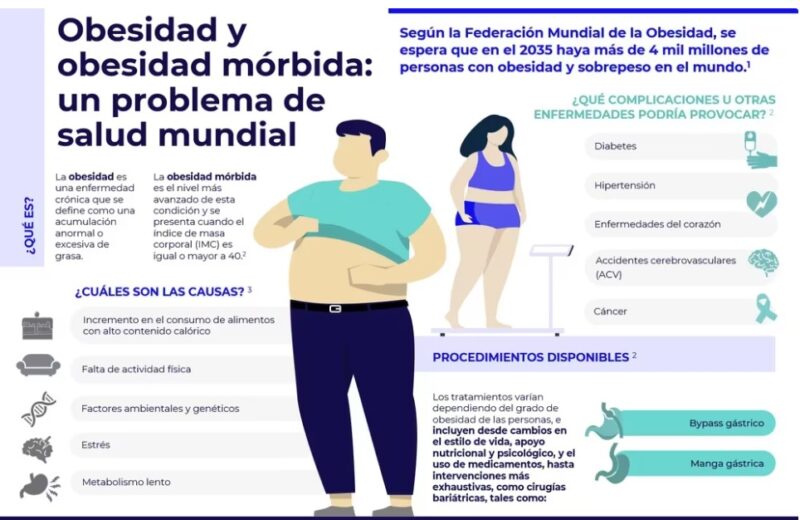 Obesidad | “Una de cada cuatro personas está enferma” destacó una médica especialista en trastornos alimenticios 3 obesidad2 1 - 2