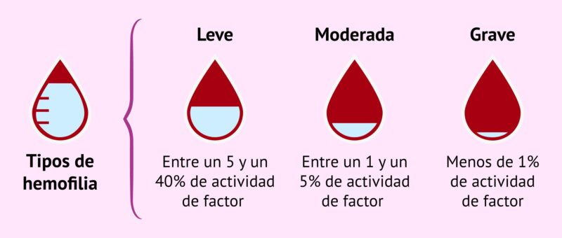 Salud | Hemofilia, una enfermedad poco frecuente que afecta a algunos varones misioneros 3 tipos - 2