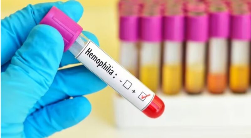 Salud | Día mundial de la hemofilia, la importancia de avanzar hacia un acceso equitativo a los diversos tratamientos hemofilia 1 - 2