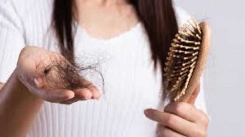 Dengue | Especialista explica la caída del cabello cómo un síntoma posterior a la enfermedad cabello 1 - 5