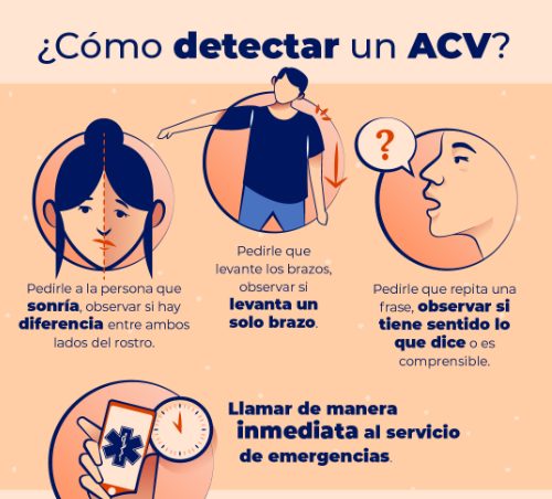 Día mundial del accidente cerebrovascular | Cada año 120 mil argentinos sufren un ACV 4 sintomas ACV - 3