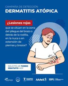 dermatitis