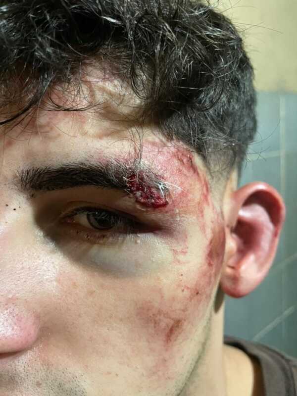 Brutal golpiza en un boliche de Posadas: “Me arrastraron a un lugar sin cámaras y pensé que me mataban” 3 posadas