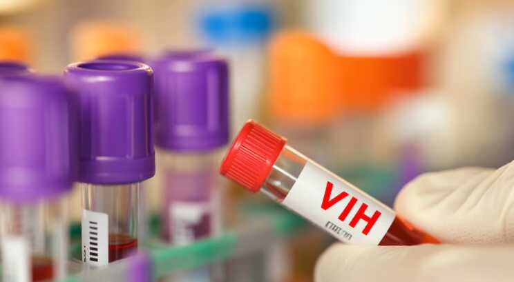 La OMS incorpora la terapia doble contra el VIH y reconoce el aporte de la ciencia argentina 3 vih2 - 2