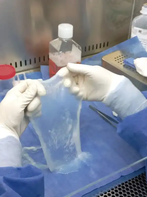 Misiones desarrolla parches biológicos con placenta para tratar quemaduras y heridas complejas 2 placenta