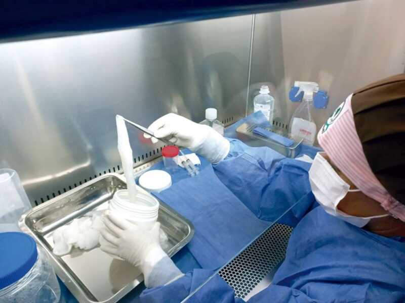 Misiones desarrolla parches biológicos con placenta para tratar quemaduras y heridas complejas 1 placenta