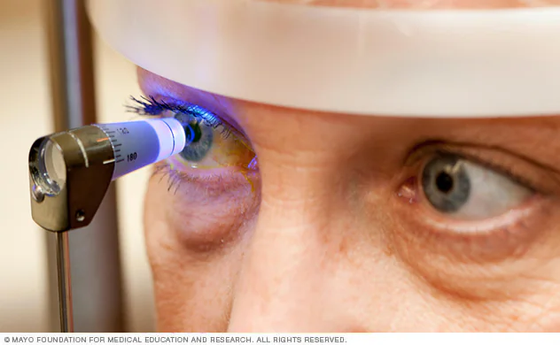 Glaucoma: la enfermedad silenciosa que ya afecta a más de un millón de argentinos 2 Glaucoma
