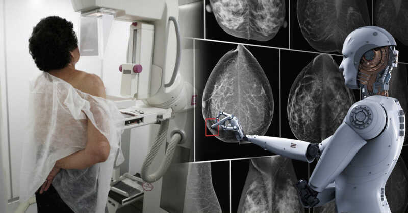 Rusia desarrolla una inteligencia artificial que detecta el cáncer de mama en minutos 3 Rusia