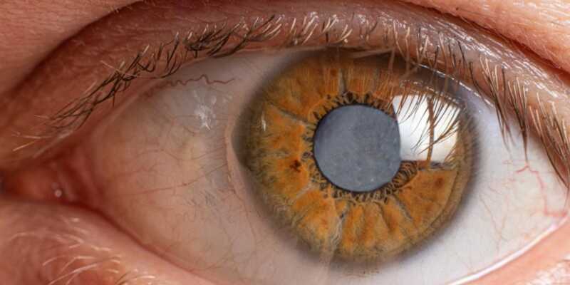 Semana Mundial del Glaucoma: En la Argentina el 50% de la población desconocen que la poseen 1 El glaucoma es una enfermedad ocular silenciosa que daña el nervio óptico y puede provocar pérdida de visión si no se detecta a tiempo.