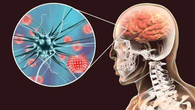 HII6i5mXgAAPlEG - 5