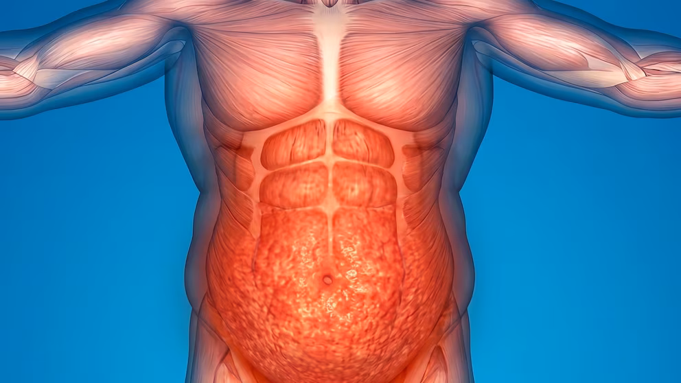 Apnea del sueño: una terapia para la obesidad muestra resultados alentadores 7 ERMVWWE4QVD2FOJAEobesidad3WAPUG3SZA - 6
