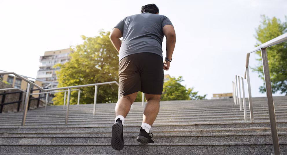 Apnea del sueño: una terapia para la obesidad muestra resultados alentadores 5 obesidad2 - 4